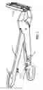 Fig. 02 - SURGICAL PURSE-STRING SUTURING INSTRUMENT