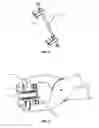 Fig. 06 - SURGICAL PURSE-STRING SUTURING INSTRUMENT