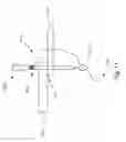 Fig. 13 - Threadable knot soft tissue defect repair system