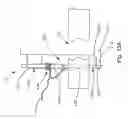 Fig. 16 - Threadable knot soft tissue defect repair system