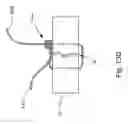 Fig. 22 - Threadable knot soft tissue defect repair system