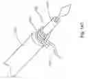 Fig. 25 - Threadable knot soft tissue defect repair system