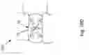 Fig. 29 - Threadable knot soft tissue defect repair system