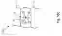 Fig. 31 - Threadable knot soft tissue defect repair system