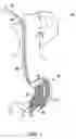 Fig. 02 - METHOD AND APPARATUS FOR TREATING OBESITY AND CONTROLLING WEIGHT GAIN USING ADJUSTABLE INTRAGASTRIC DEVICES