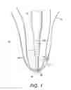 Fig. 02 - Method of forming knotless double row construct with graft or patch fixed under repair site