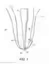 Fig. 02 - Method for creating knotless double row construct with medial row closure