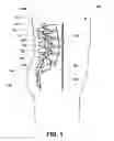 Fig. 02 - Multi-chamber expandable interspinous process spacer