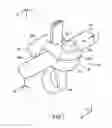Fig. 02 - Fixing devices and stabilization systems using said fixing devices