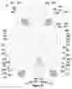 Fig. 32 - METHODS FOR AUTONOMIC NEUROMODULATION FOR THE TREATMENT OF SYSTEMIC DISEASE