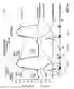 Fig. 07 - Hemodynamic stability assessment based on heart sounds