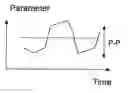 Fig. 01 - Method and apparatus for determining variation over time of a medical parameter of a human being