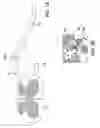 Fig. 02 - Pain management with stimulation subthreshold to paresthesia