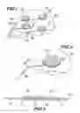 Fig. 02 - Medical Electrode Assembly