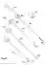 Fig. 02 - Device for implanting a vascular prosthesis