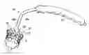 Fig. 01 - Prosthetic heart valve system with positioning markers