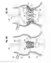 Fig. 08 - Prosthetic heart valve system with positioning markers