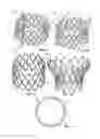 Fig. 02 - Valve prosthesis with movably attached claspers with apex