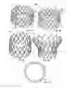 Fig. 02 - Methods for delivery of a sutureless pulmonary or mitral valve
