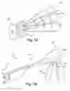 Fig. 02 - Pre-sized prosthetic chordae implantation system