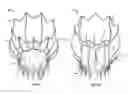 Fig. 02 - Collapsible/expandable prosthetic heart valves with native calcified leaflet retention features