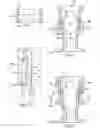 Fig. 03 - Ratcheting expandable corpectomy/vertebrectomy cage