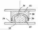 Fig. 01 - Intervertebral disk prosthesis