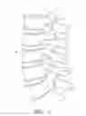 Fig. 02 - Flanged interbody fusion device