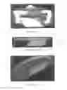 Fig. 08 - SURGICALLY IMPLANTABLE KNEE PROSTHESIS WITH CAPTURED KEEL