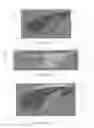 Fig. 28 - SURGICALLY IMPLANTABLE KNEE PROSTHESIS WITH CAPTURED KEEL