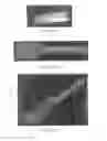 Fig. 35 - SURGICALLY IMPLANTABLE KNEE PROSTHESIS WITH CAPTURED KEEL
