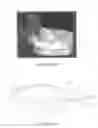 Fig. 40 - SURGICALLY IMPLANTABLE KNEE PROSTHESIS WITH CAPTURED KEEL