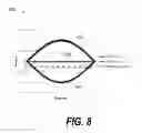 Fig. 09 - Providing constant counterbalance throughout predetermined range of motion