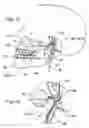 Fig. 02 - METHODS AND APPARATUS FOR REDUCTION OF LACTATE