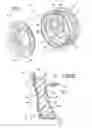 Fig. 02 - VEHICLE WHEEL CONSTRUCTION PROCESS