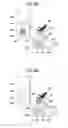 Fig. 05 - Substrate replacing method and substrate processing apparatus