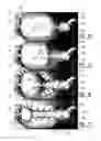 Fig. 08 - Container with deformable inner container and method of manufacture thereof