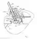 Fig. 05 - DRINK TAPPING DEVICE FOR A KEG AND DISPENSING DEVICE COMPRISING THE TAPPING DEVICE AND A KEG