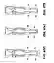 Fig. 09 - PINCH GRIP HANGERS