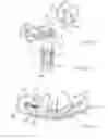 Fig. 06 - Endless track suspension
