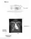 Fig. 06 - Dynamic radiographing system