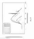 Fig. 07 - Orthovoltage radiotherapy