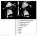Fig. 01 - SYSTEM FOR MULTIMODALITY FUSION OF IMAGING DATA BASED ON STATISTICAL MODELS OF ANATOMY