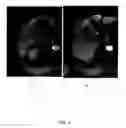Fig. 04 - AUTOMATED METHOD FOR ASSESSMENT OF TUMOR RESPONSE TO THERAPY WITH MULTI-PARAMETRIC MRI