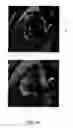 Fig. 05 - AUTOMATED METHOD FOR ASSESSMENT OF TUMOR RESPONSE TO THERAPY WITH MULTI-PARAMETRIC MRI