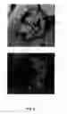 Fig. 08 - AUTOMATED METHOD FOR ASSESSMENT OF TUMOR RESPONSE TO THERAPY WITH MULTI-PARAMETRIC MRI