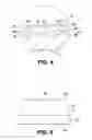 Fig. 04 - Load transmitting insert for a soft spline body
