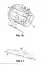 Fig. 07 - Load transmitting insert for a soft spline body