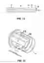 Fig. 08 - Load transmitting insert for a soft spline body