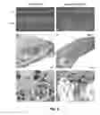Fig. 07 - Methods for the treatment of tinnitus induced by cochlear excitotoxicity